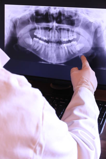 Best Emergency Dentist for Knocked-Out Tooth in Dumas, TX